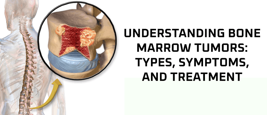 Understanding Bone Marrow Tumors