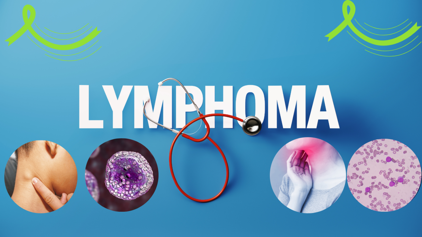 Lymphoma