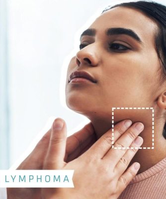 lymphoma