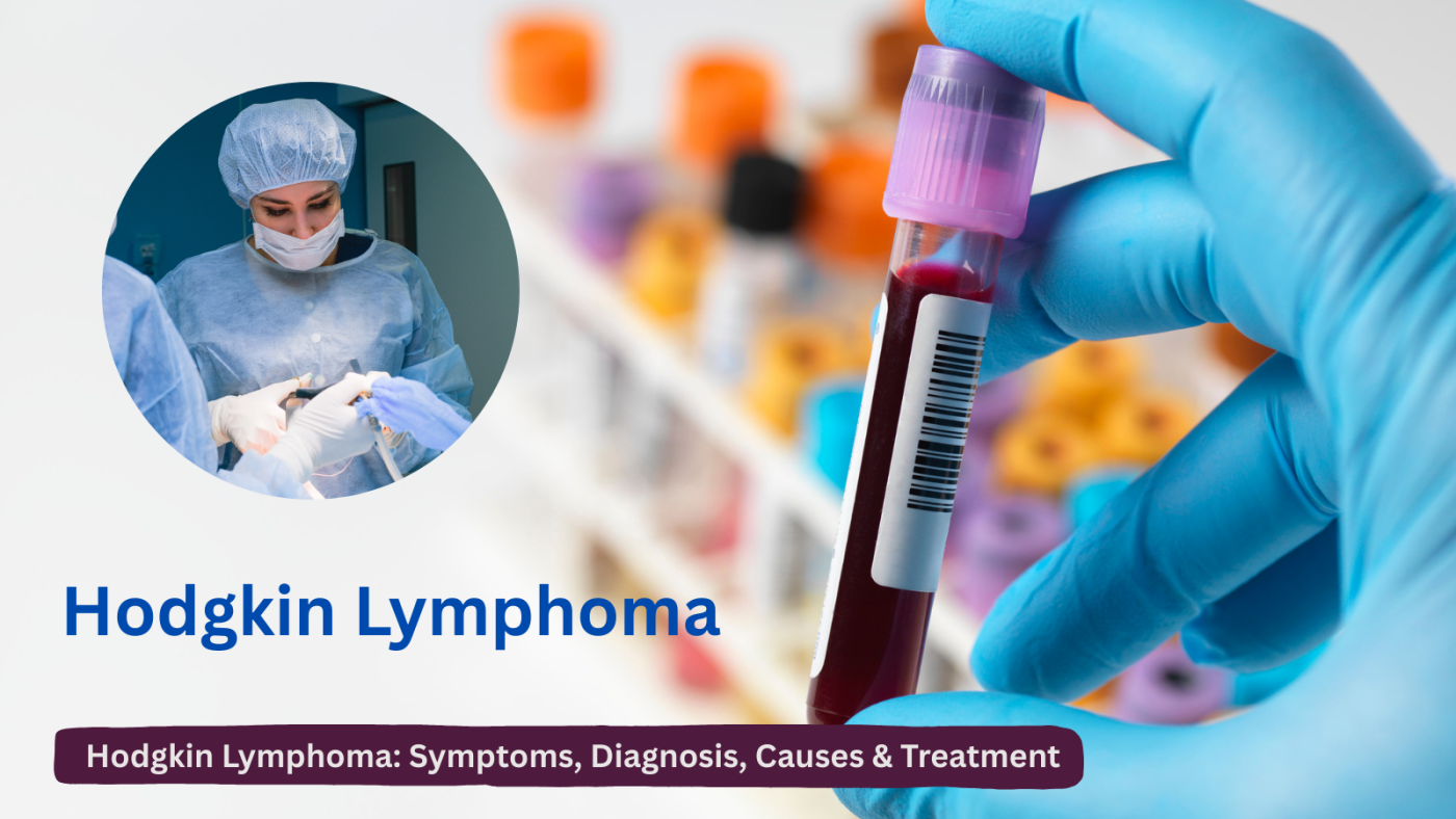 Hodgkin Lymphoma symptoms, diagnosis and treatment