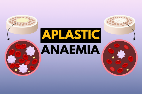Aplastic-Anaemia