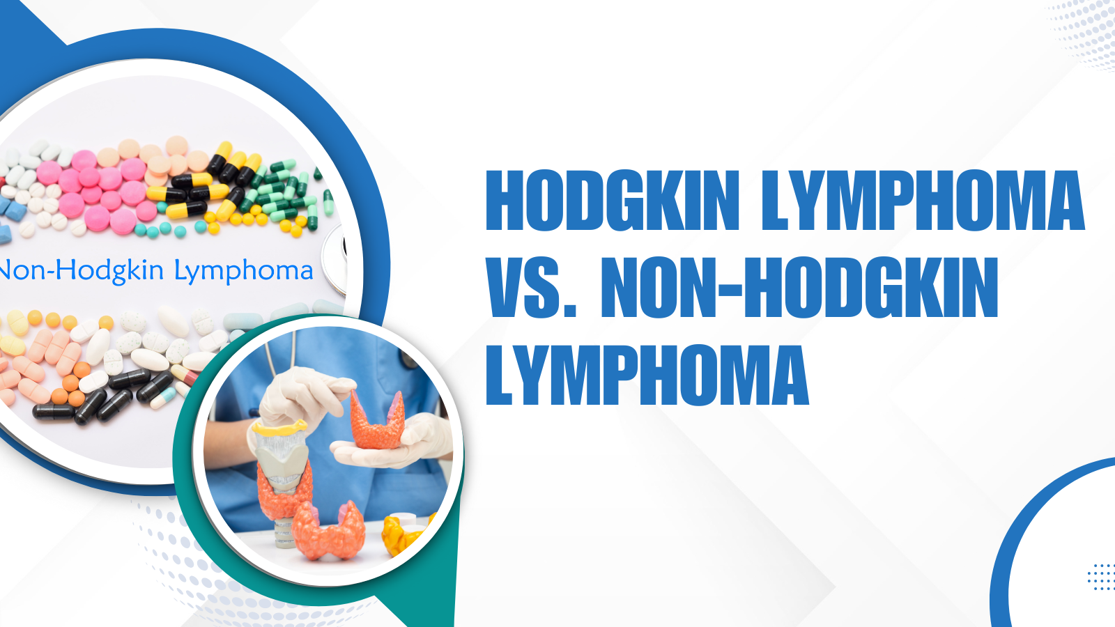 Hodgkin Lymphoma vs. Non-Hodgkin Lymphoma: Understanding the Key ...