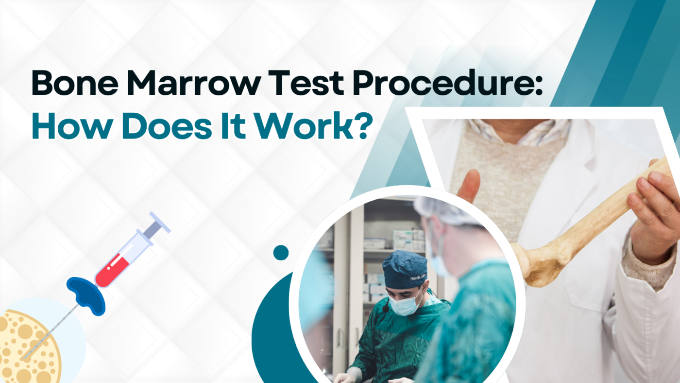 Illustration explaining the bone marrow test procedure and biopsy process