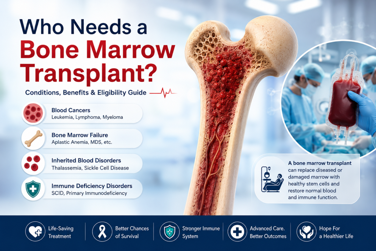 Illustration of a bone marrow transplant showing a cross-section of a human bone with healthy marrow, a blood stem cell transplant procedure, and key conditions requiring transplantation, including blood cancers, bone marrow failure, inherited blood disorders, and immune deficiency disorders. The image highlights the benefits of bone marrow transplantation such as improved survival, stronger immunity, and better treatment outcomes.